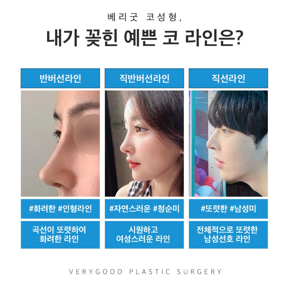 직반코성형? 베리굿성형외과💙 화려하게,자연스럽게✨ 관련 이미지 2
