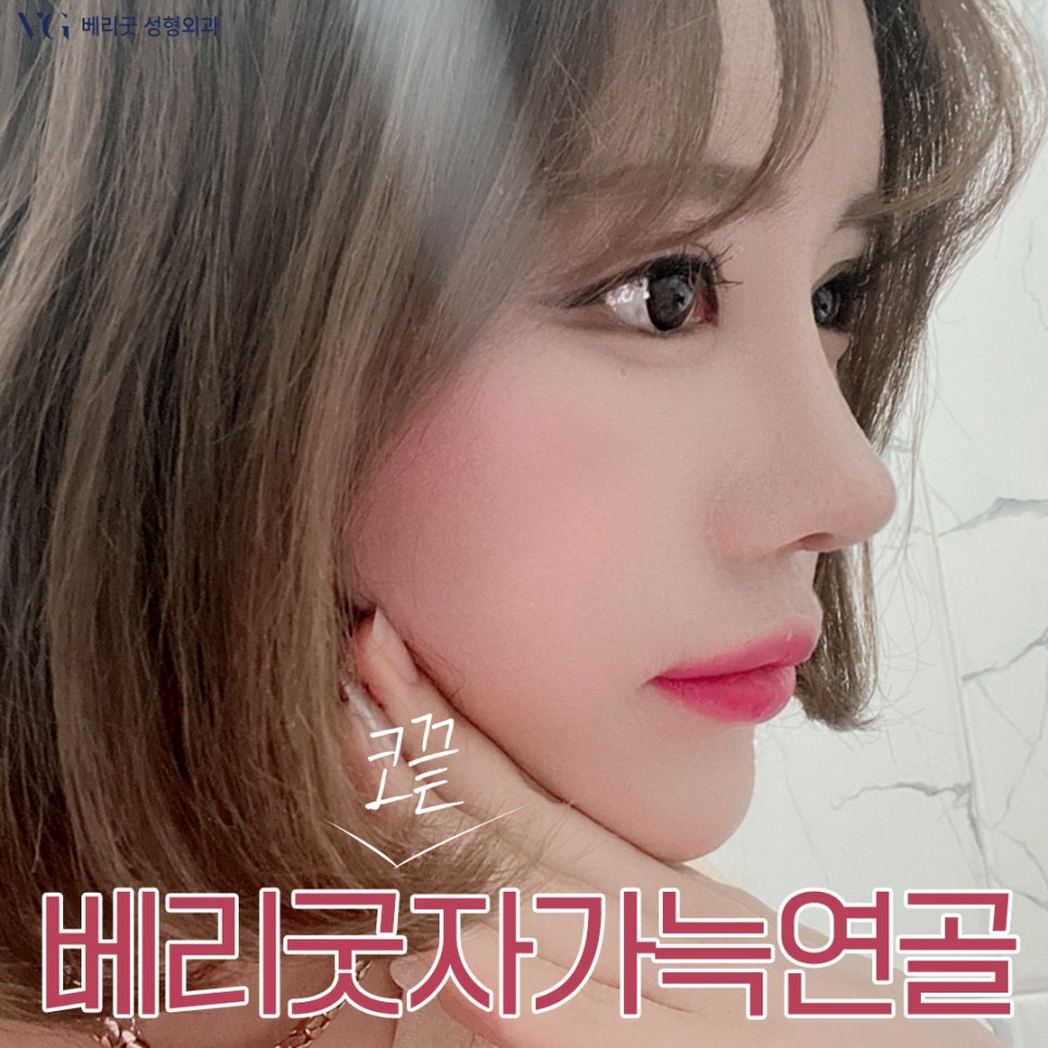 코끝도 베리굿💯#자가늑연골 #반버선 #직반버선 #베리굿성형외과 관련 이미지 1