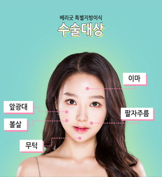 베리굿 풀페이스 지방이식으로 동안 미모로 변신! 관련 이미지 4