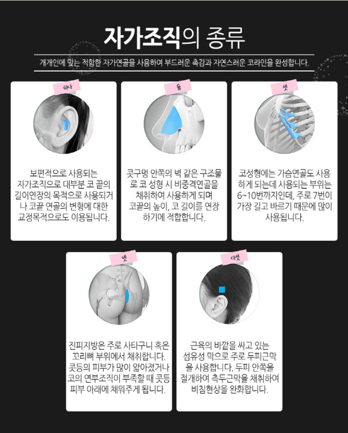 코성형 꼼꼼하게 알고 하자 관련 이미지 6