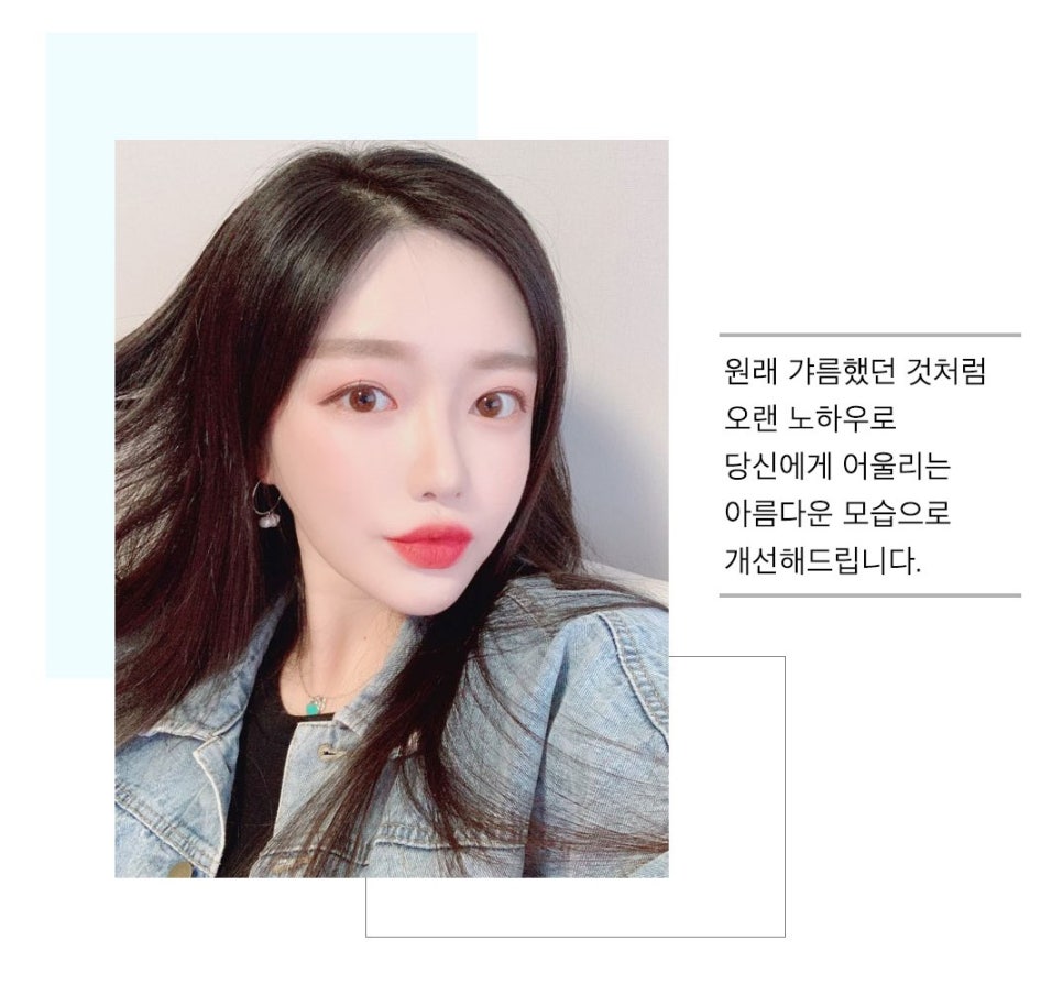 지방흡입으로 안면윤곽의 효과를?? 관련 이미지 1