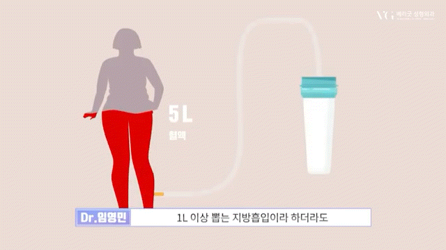 안전성형지향 강남성형외과 , 성형알아볼때 병원 선택법 ? 수혈가능한 병원으로 선택하세요 관련 이미지 7