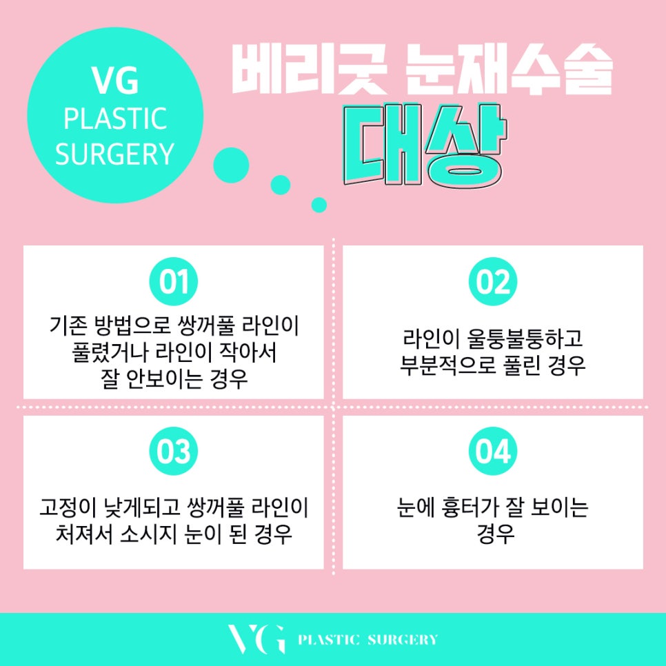 눈재수술잘하는곳, 눈재수술가격 관련 이미지 2