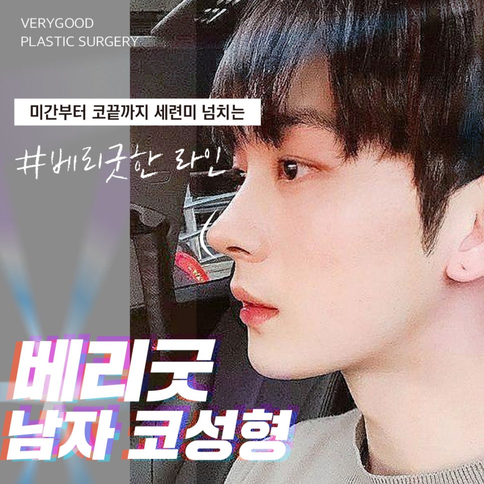 남자코성형,남자코성형가격, 관련 이미지 1