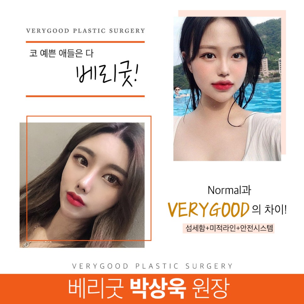 남자코성형 잘알아보고 확실하게 관련 이미지 8