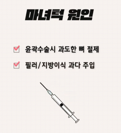 강남역 마녀턱 턱끝거상 , 리프팅원인 수술방법 총정리 관련 이미지 6