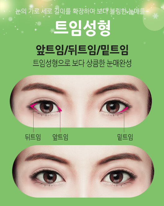 베리굿성형외과 관련 이미지 10