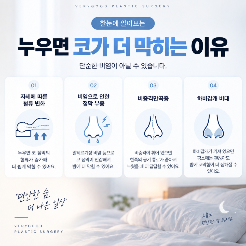 누우면 코가 더 막히는 이유는? 밤마다 반복되는 코막힘과 비염코수술 관련 이미지 2