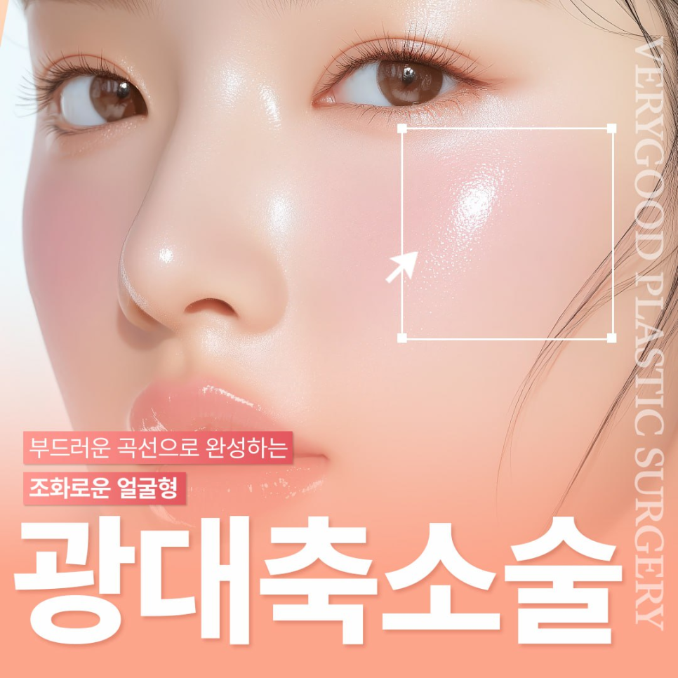 베리굿성형외과 광대축소술, 쉐딩이 필요없는 정면에서도 작아 보이는 입체 윤곽라인 관련 이미지 1