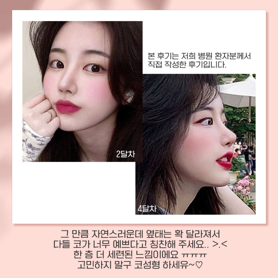 베리굿성형외과가 추천하는 성형별 추천👏 관련 이미지 4