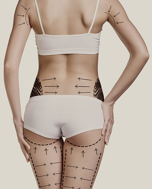 내가 뽑고 싶은 부위만💛미니지방흡입 관련 이미지 5