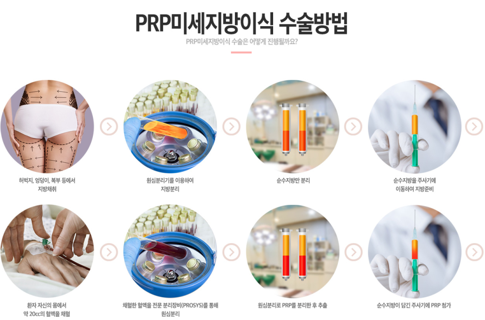 베리굿 걸을 위한 베리굿성형외과 PRP지방이식✨ 관련 이미지 5