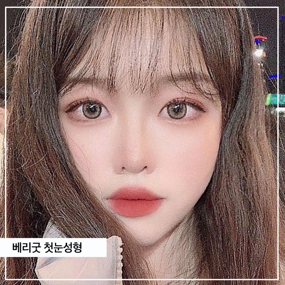 베리굿성형외과💖첫눈성형도 베리굿하게🎄 관련 이미지 8