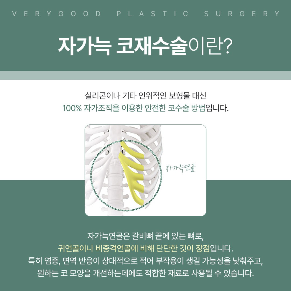 코끝 처짐&middot;라인 불만족, 강남역 자가늑 코재수술로 해결 가능할까 관련 이미지 5