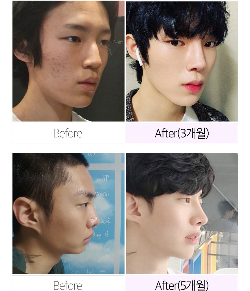 마지막 코재수술은 베리굿에서~ 관련 이미지 9