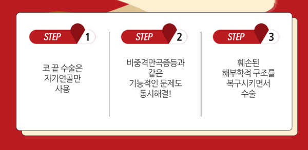 코재수술 재수술인 만큼 더 만족스럽게! 관련 이미지 4