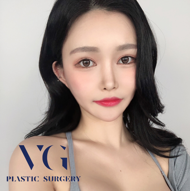 눈재수술 원인을 정확히알고 하자! 관련 이미지 4