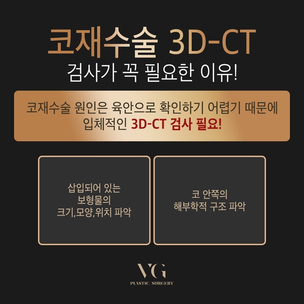 자가늑연골 코재수술 나도 해당될까? 관련 이미지 7