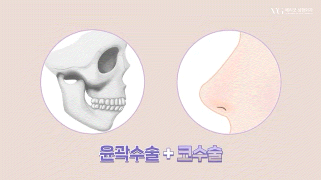 안전성형지향 강남성형외과 , 성형알아볼때 병원 선택법 ? 수혈가능한 병원으로 선택하세요 관련 이미지 17