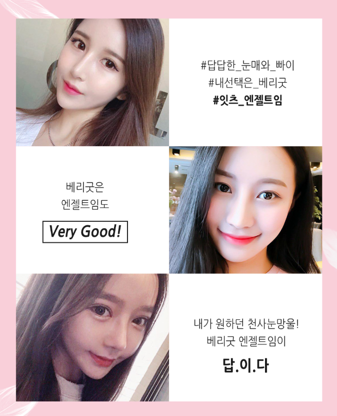 베리굿성형외과 트임성형! 내가 원하던 천사눈망울, 엔젤트임 김준현원장님 관련 이미지 2