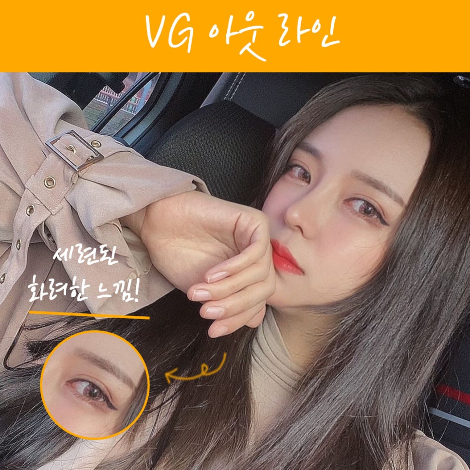 베리굿 성형외과 맞춤별 쌍수👀❤ 관련 이미지 3