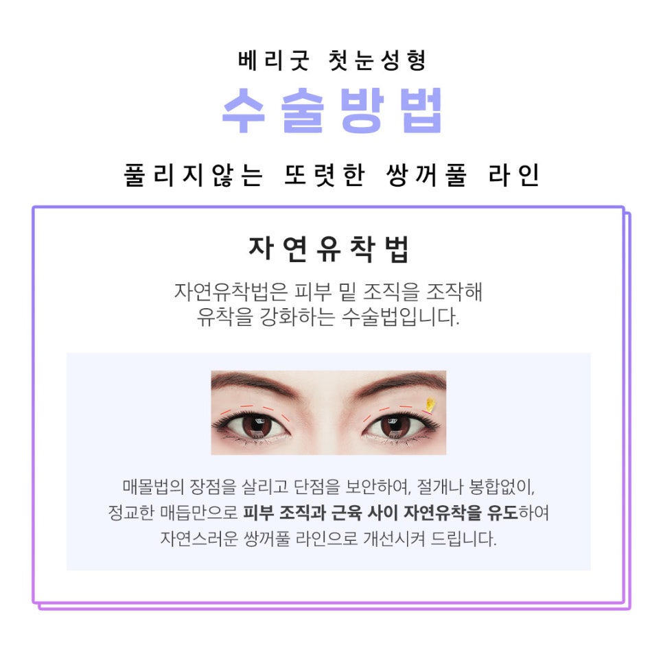 아름다운 당신을 위한 베리굿의 첫눈성형 관련 이미지 3