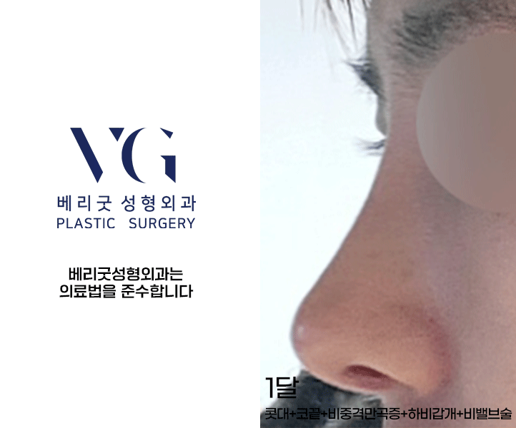 베리굿 비염코성형✨비염수술과 코성형을 동시에? 관련 이미지 8