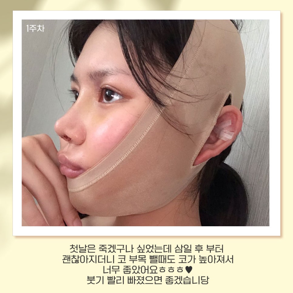 베리굿성형외과가 추천하는 성형별 추천👏 관련 이미지 7