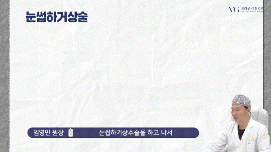 강남중년눈성형 잘하는곳 , 상안검 하안검 눈썹하거상술종류 진행방법 궁금하다면 관련 이미지 25