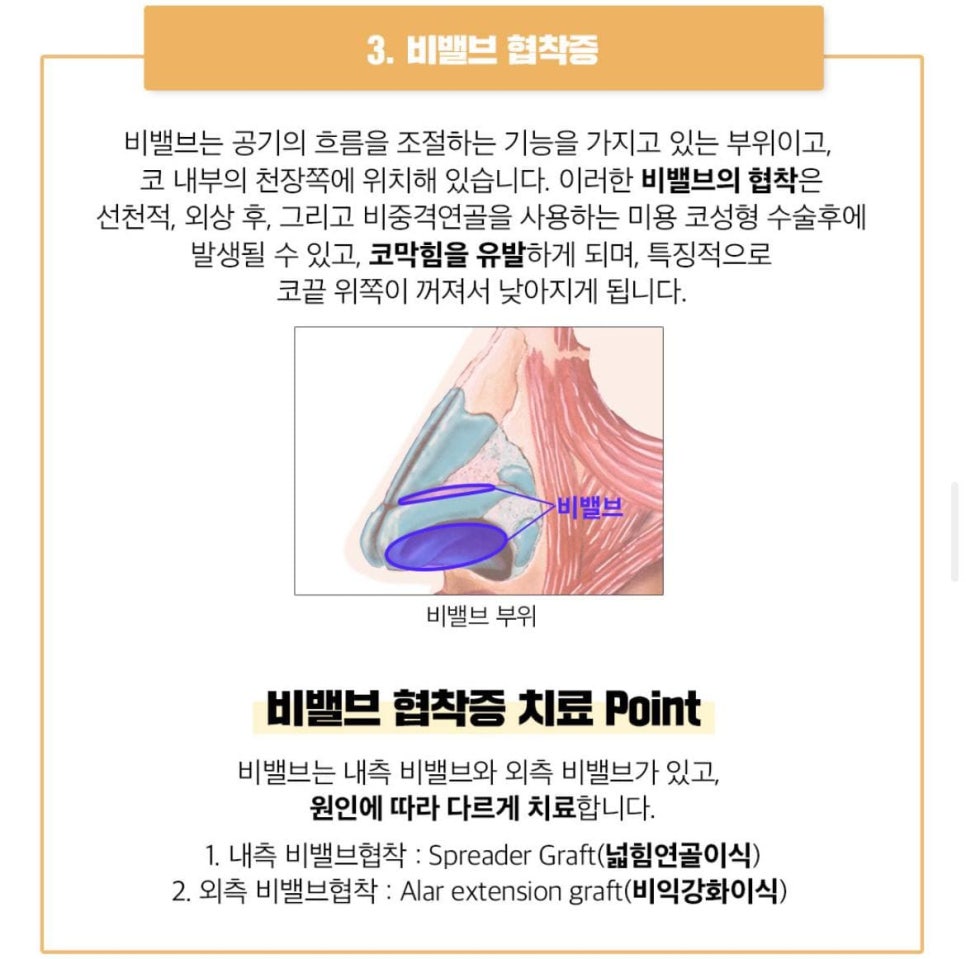 치료와 성형을 한번에[베리굿한 비염코성형] 관련 이미지 5