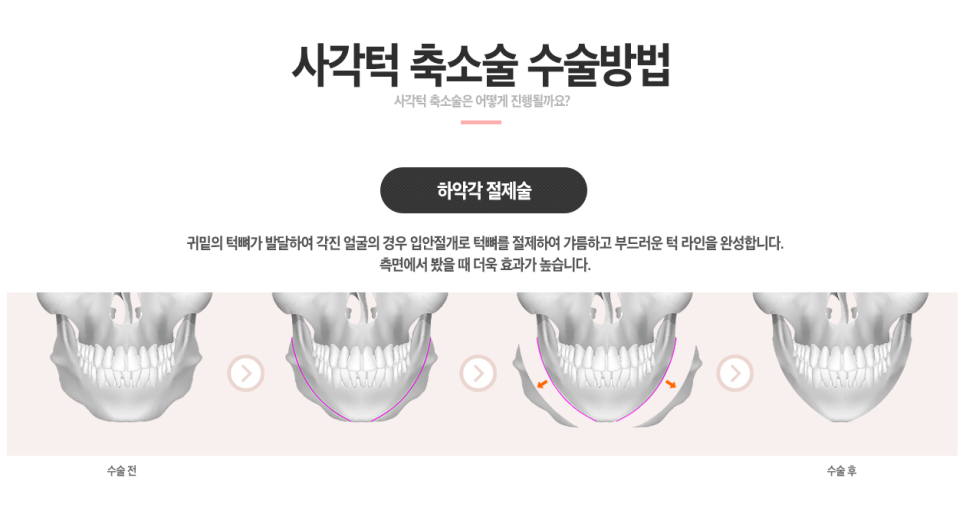 베리굿&hearts;얼굴에 찰떡! 베리굿 사각턱축소 관련 이미지 3