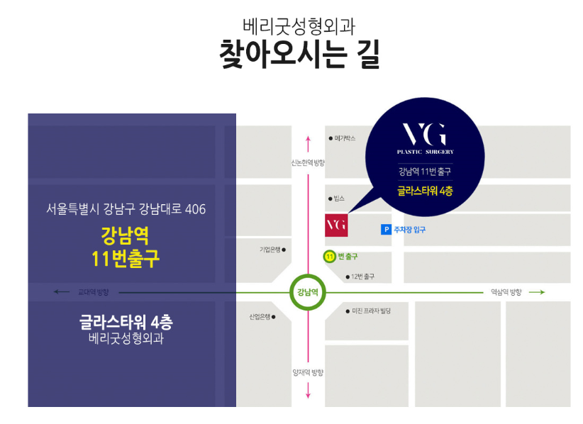 뼈수술 없이 V라인만들기! 베리굿성형외과 얼굴지방흡입 관련 이미지 11