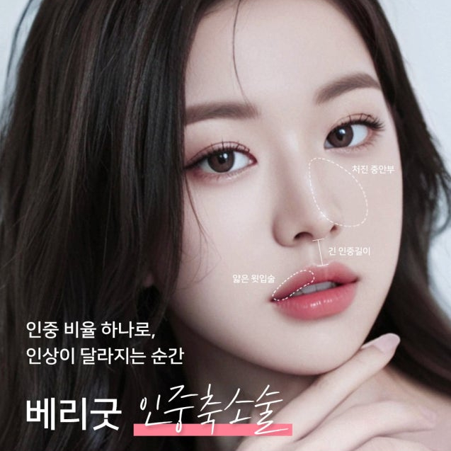 긴 인중이 짧아지면 달라지는 인상, 강남역 인중축소술 효과 총정리 관련 이미지 1