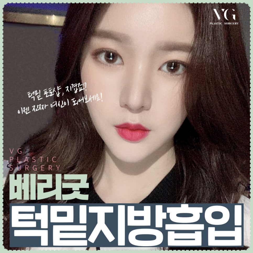 베리굿성형외과 얼굴지방흡입으로 매끄럽고 갸름하게! 관련 이미지 1