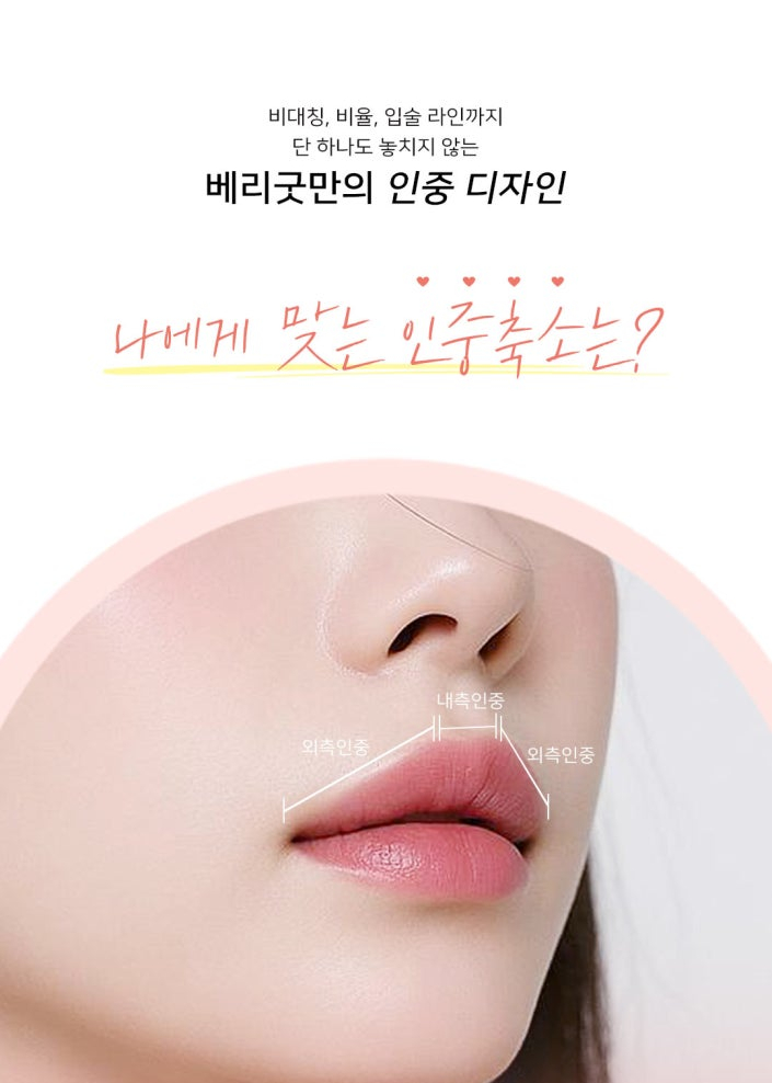 짧게보다 조화롭게! 얼굴 비율 살리는 인중축소술 알아본다면, 강남 베리굿성형외과 관련 이미지 3