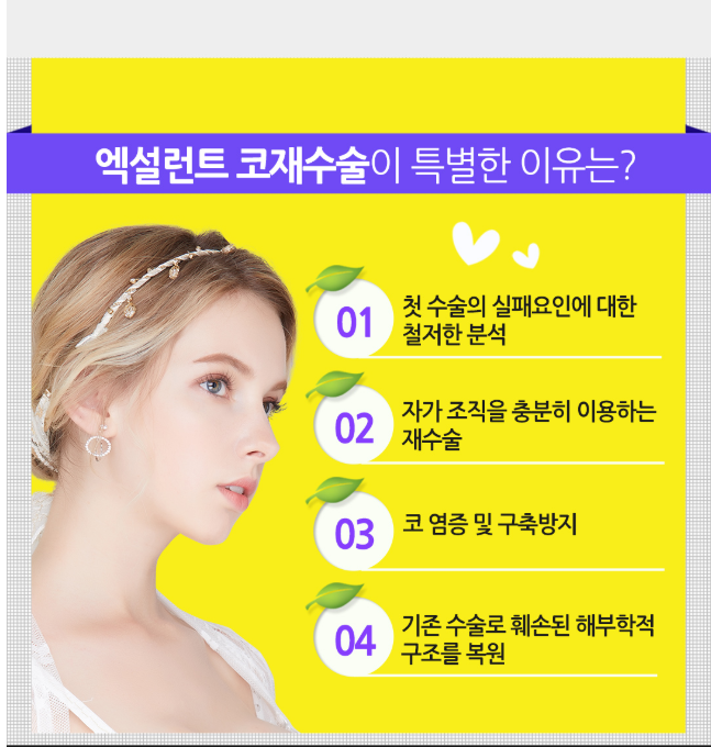 베리굿성형외과 엑설런트 코재수술! 다시 살아나는 미모의 시작~ 강남역성형외과 관련 이미지 5