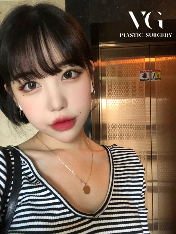 코재수술 재수술인 만큼 더 만족스럽게! 관련 이미지 1