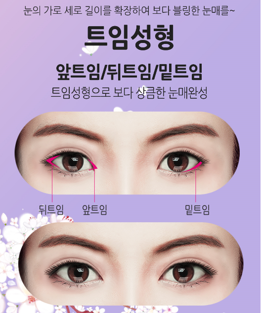 내게 맞는 라인으로 쌍꺼풀수술 잘하는곳 관련 이미지 4
