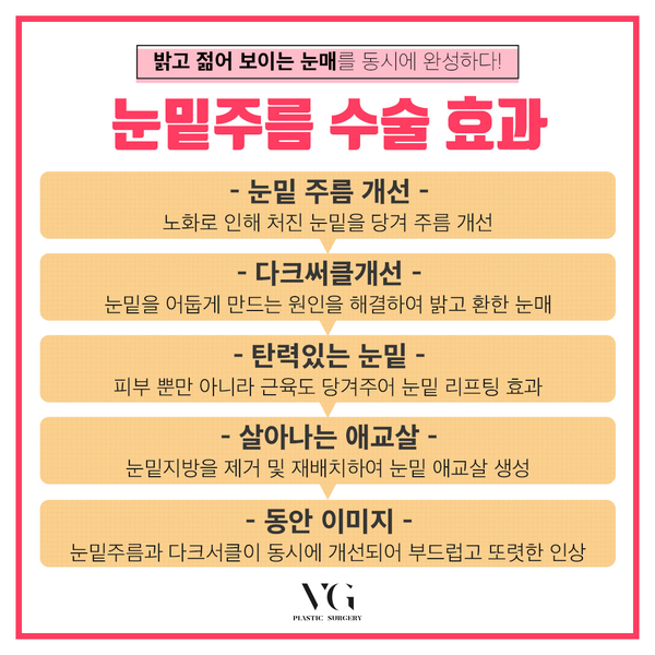 40~50대 눈밑주름고민, 하안검수술로 해결하자! 관련 이미지 4