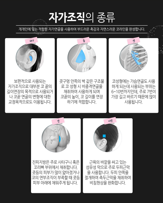 코성형 내게맞는 라인으로 관련 이미지 5