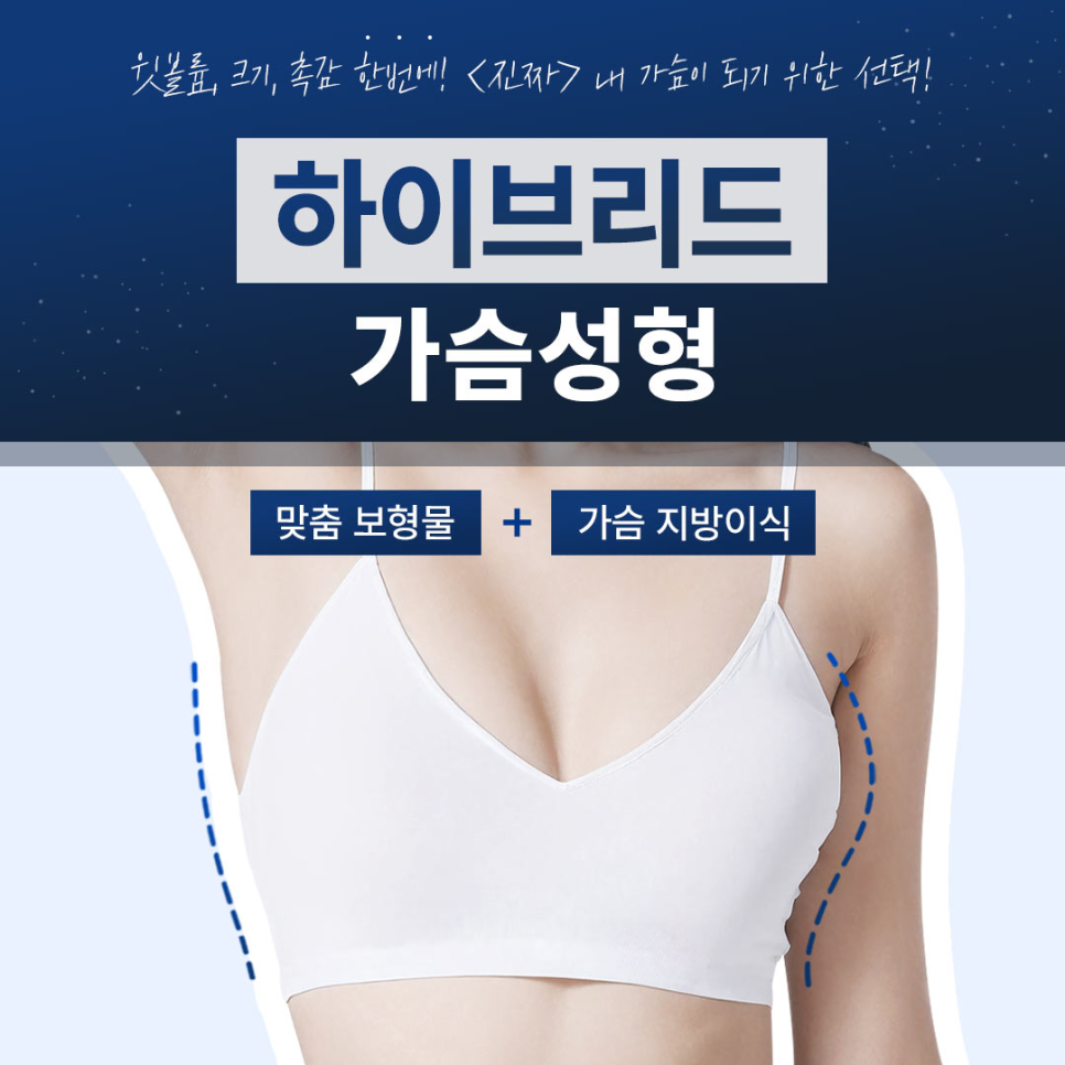 지방이식과 보형물의 장점만! 베리굿 하이브리드 가슴성형 자세히 알아보기 관련 이미지 1