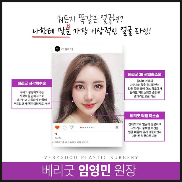 사각턱축소술 수술방법부터 주의사항까지 확실하게 관련 이미지 3