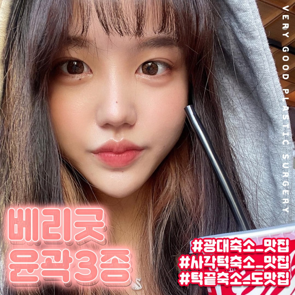 안면윤곽비용 , 비용만 생각해선 안돼 관련 이미지 9