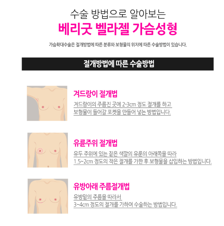 말랑말랑, 촉감이 다른 베리굿성형외과 벨라젤 가슴성형! 강남역성형외과 임영민 원장님 관련 이미지 4