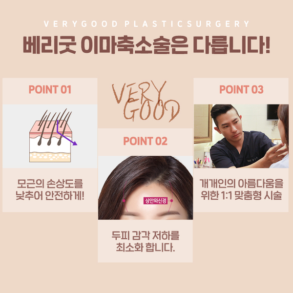 넓은이마 이마축소로 만족스럽게! 관련 이미지 3