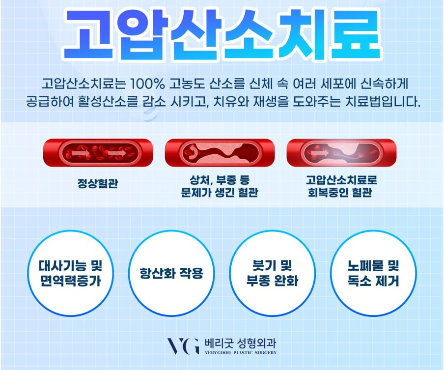 강남 고압산소치료 병원 , 면역력향상 부터 수술 후 회복까지 비용 효과 궁금하다면 관련 이미지 7