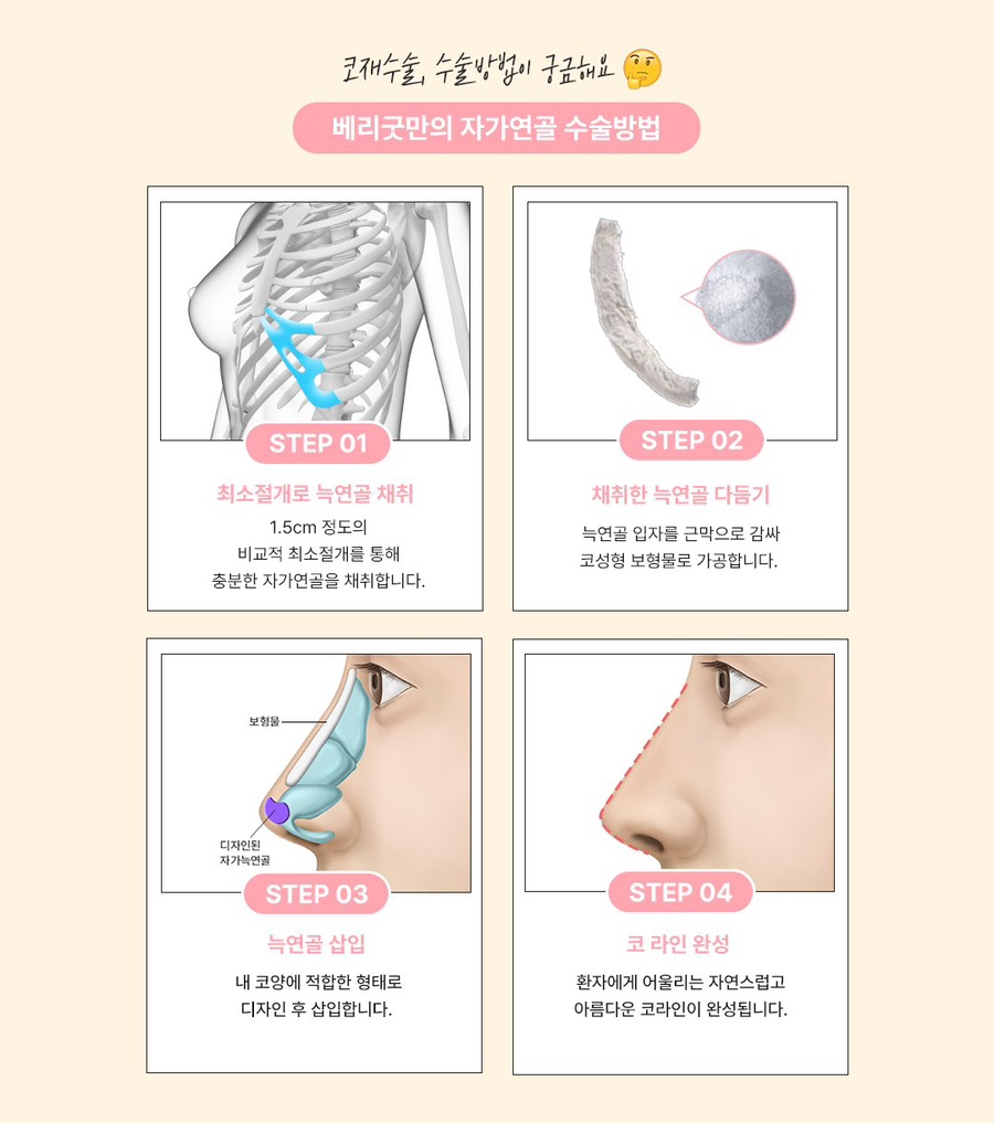 강남 코재수술 병원, 단순 재수술이 아닌 구조 재설계가 중요한 이유 관련 이미지 3