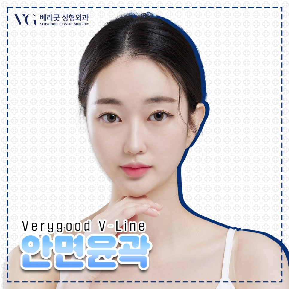 안면윤곽비용 , 비용만 생각해선 안돼 관련 이미지 1