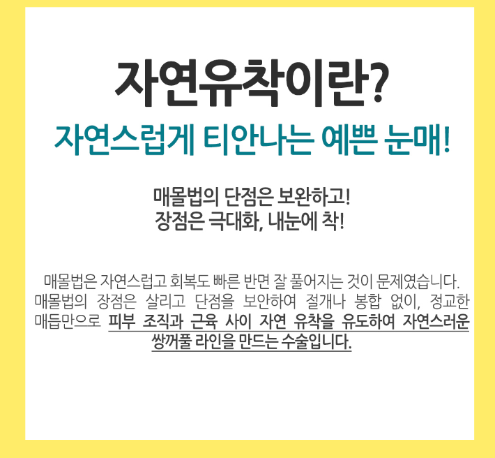 눈성형잘하는곳 내게 맞는 눈매라인에 맞게 관련 이미지 5
