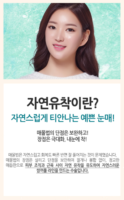 눈성형잘하는곳 잘고르는법 관련 이미지 4